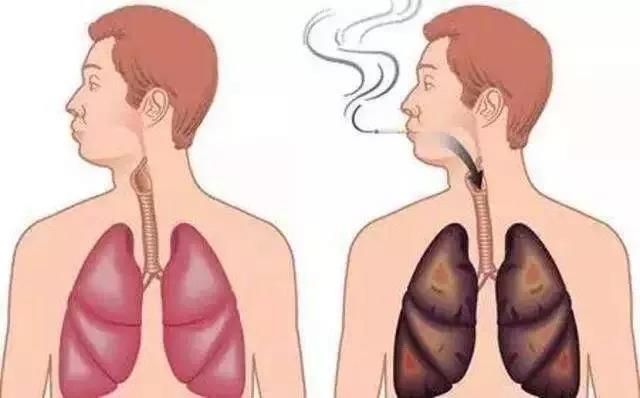 肺癌预防 | 电子烟诱发小鼠肺腺癌再添石锤，对吸烟人士的再次警示！