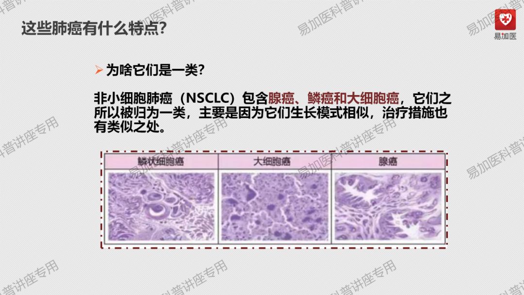 肺癌治疗|朱淼勇医师讲解：正确认识肺癌及肺癌的治疗方式