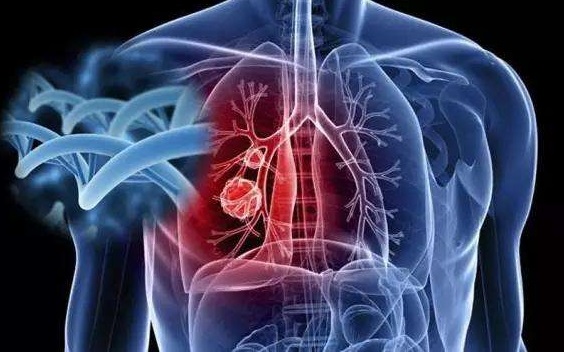 肺癌治疗 | 确诊肺癌之后，看诊不知从何问起？记住问这7个问题！
