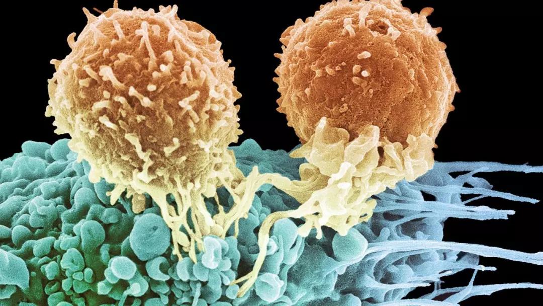 肺癌治疗|TMB高表达的非小细胞肺癌患者对免疫治疗效果更好又添实证