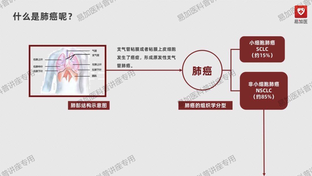 肺癌治疗 | 王懿娜教授：晚期非小细胞肺癌（NSCLC）靶向治疗及耐药后选择